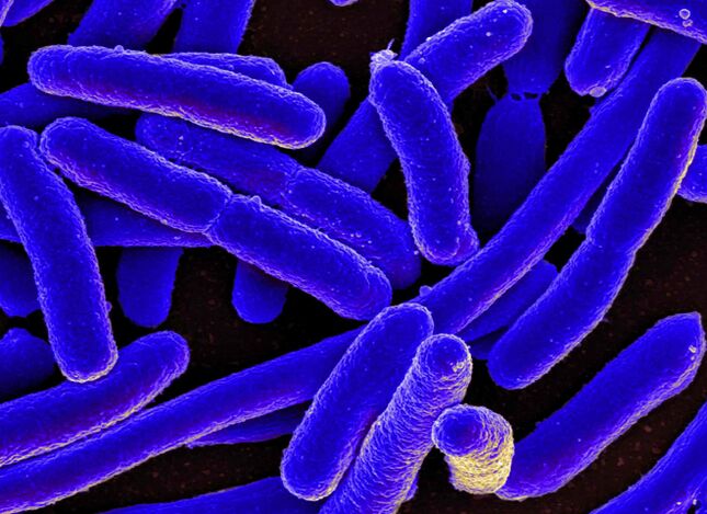 E. coli اغلب باعث ایجاد سیستیت در زنان می شود